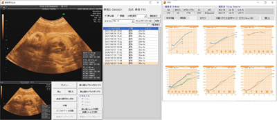 エコー画像＆成長曲線
