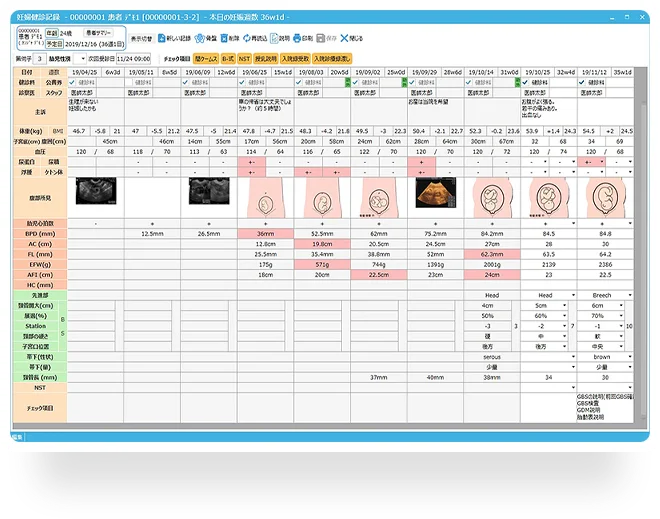 産婦人科専用電子カルテの画面